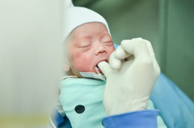 pentingnya-stimulasi-oral-pada-bayi-prematur
