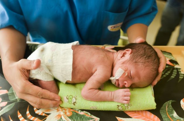fisioterapi-untuk-bayi-prematur