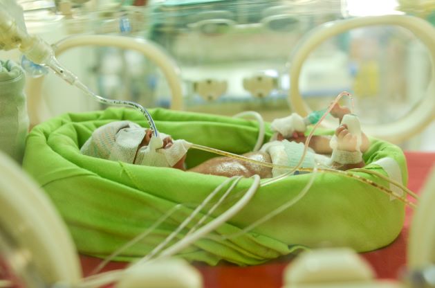 gangguan-perkembangan-bayi-prematur
