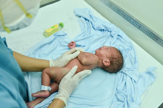 merawat-kulit-bayi-prematur